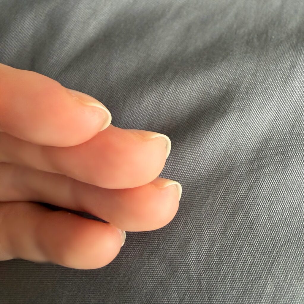 ネイルエンビー_ハイポニキウム育成効果

