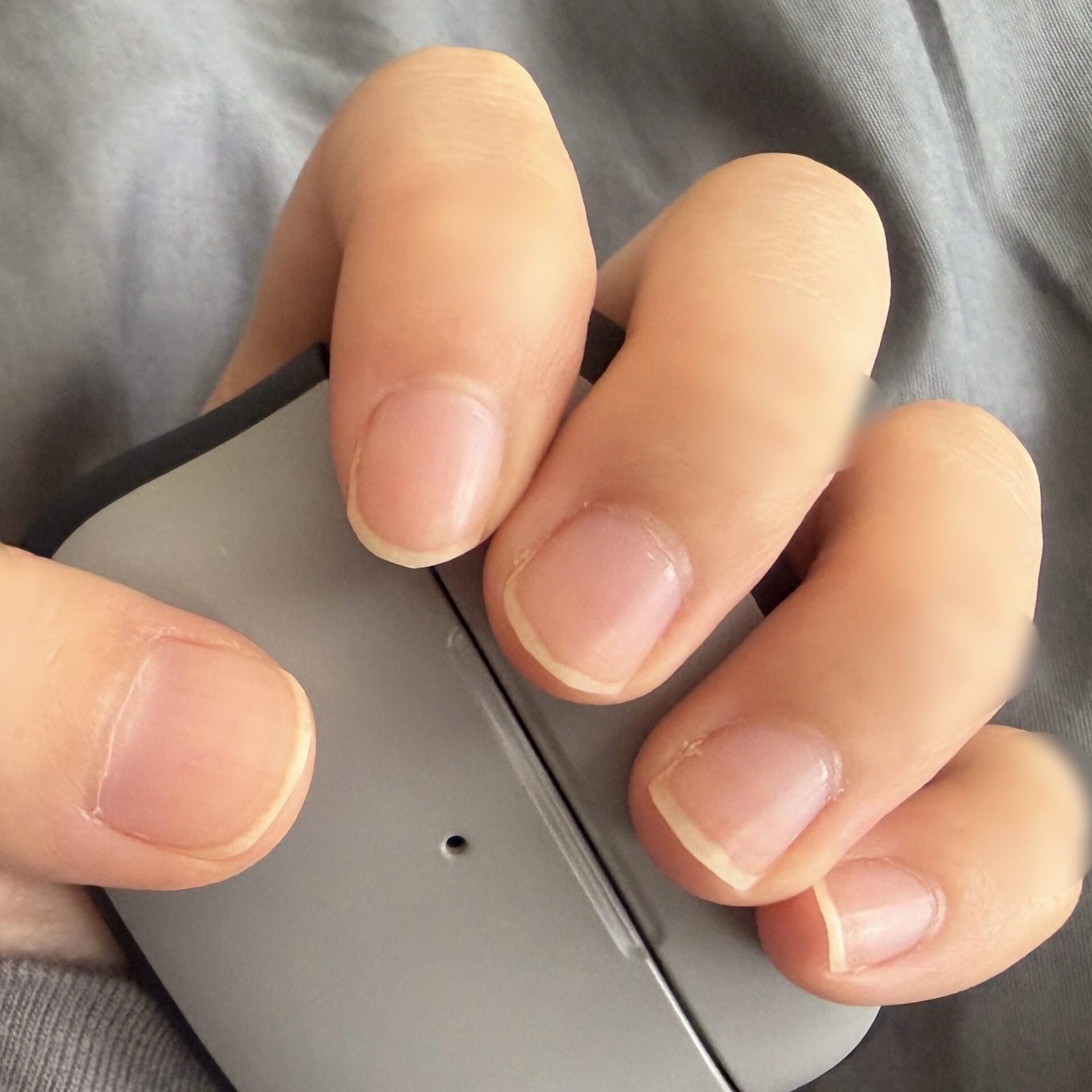 育爪をやめた後の爪全体